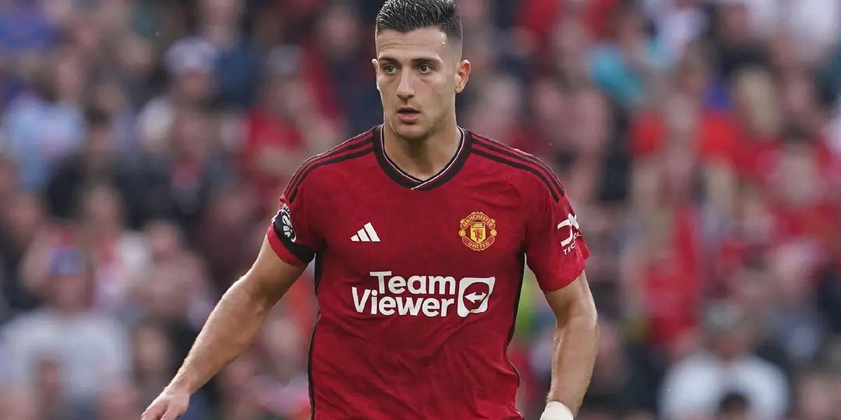 Manchester United ended the game with only 10 man on the field.